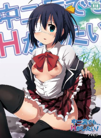 中二病でもエッチがしたい!の表紙画像